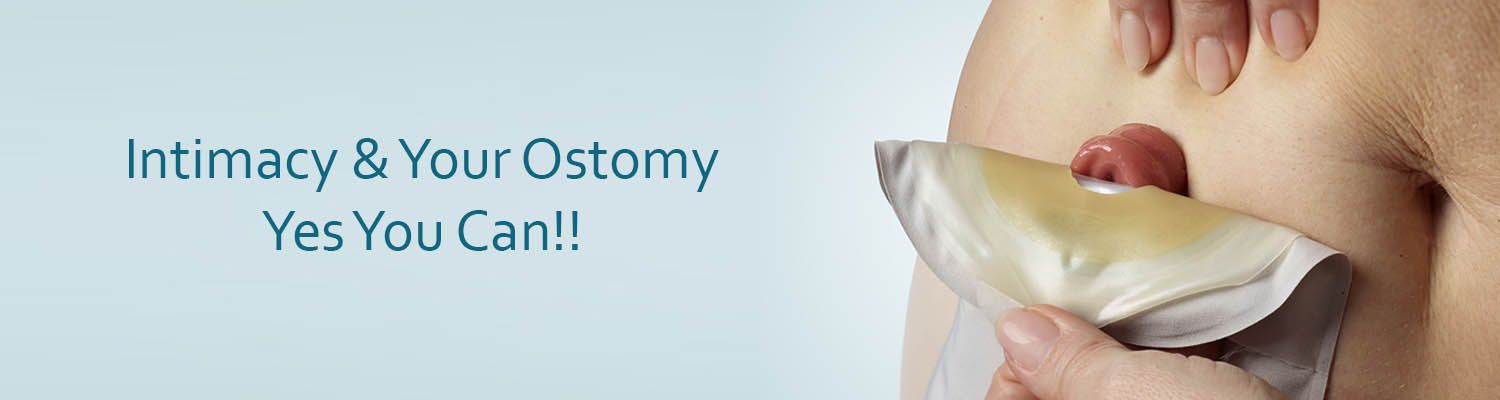 Intimacy and Your Ostomy: Yes You Can!!