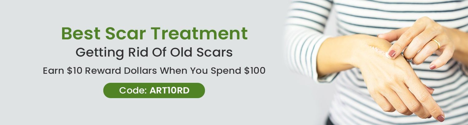 Best Scar Treatment : Getting Rid Of Old Scars