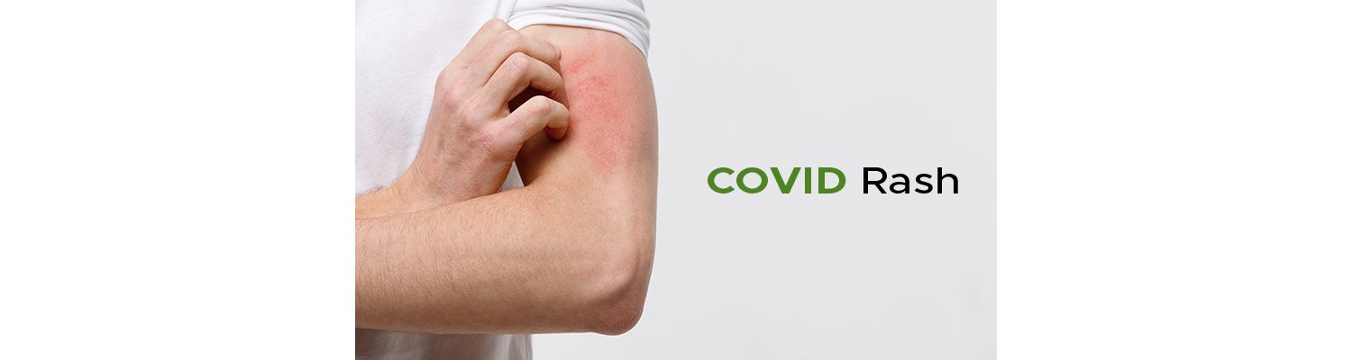 COVID Rash and Unusual COVID Symptoms