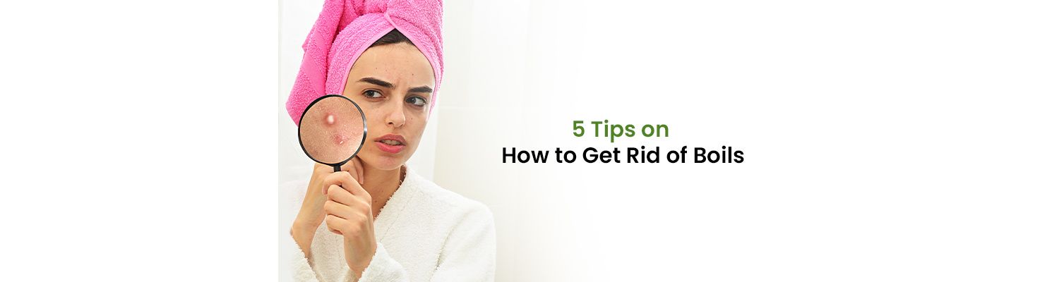 5 Tips on How to Get Rid of Boils