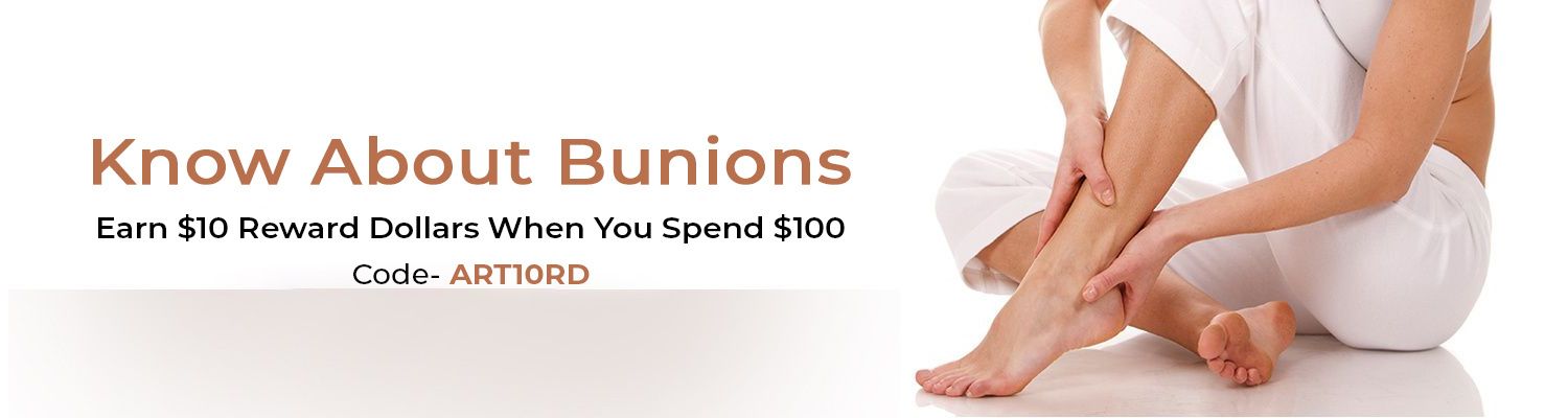 A Brief Guide to Bunions