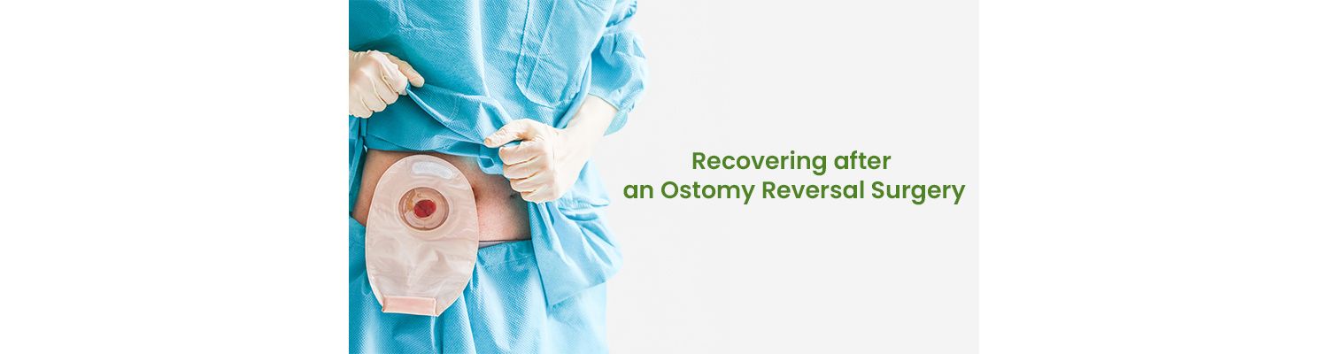 Recovering after an Ostomy Reversal Surgery