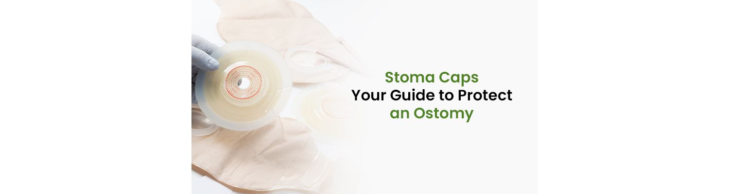 Stoma Caps: Your Guide to Protect an Ostomy