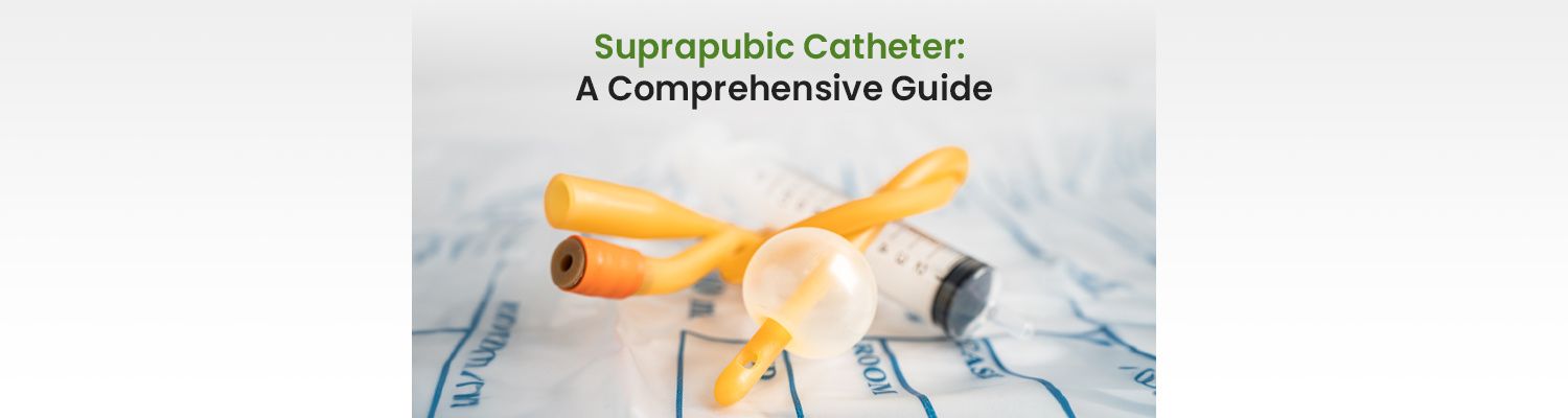 Suprapubic Catheter: A Comprehensive Guide