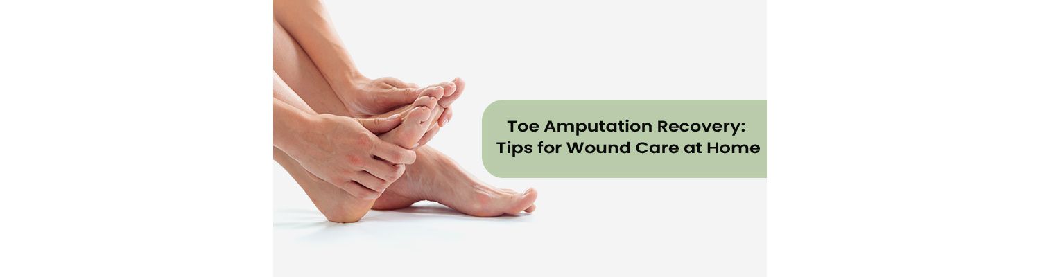 Toe Amputation Recovery: Tips for Wound Care at Home