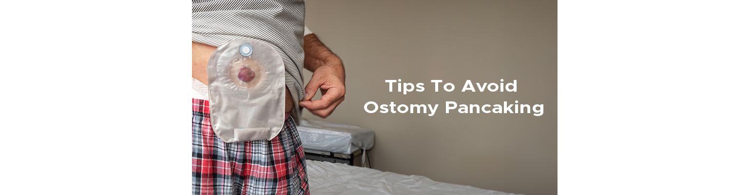 10 Tips To Prevent Ostomy Pancaking