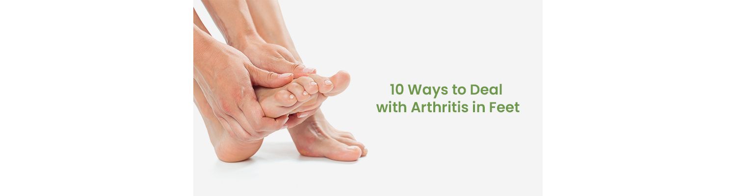 10 Ways to Deal with Arthritis in Feet