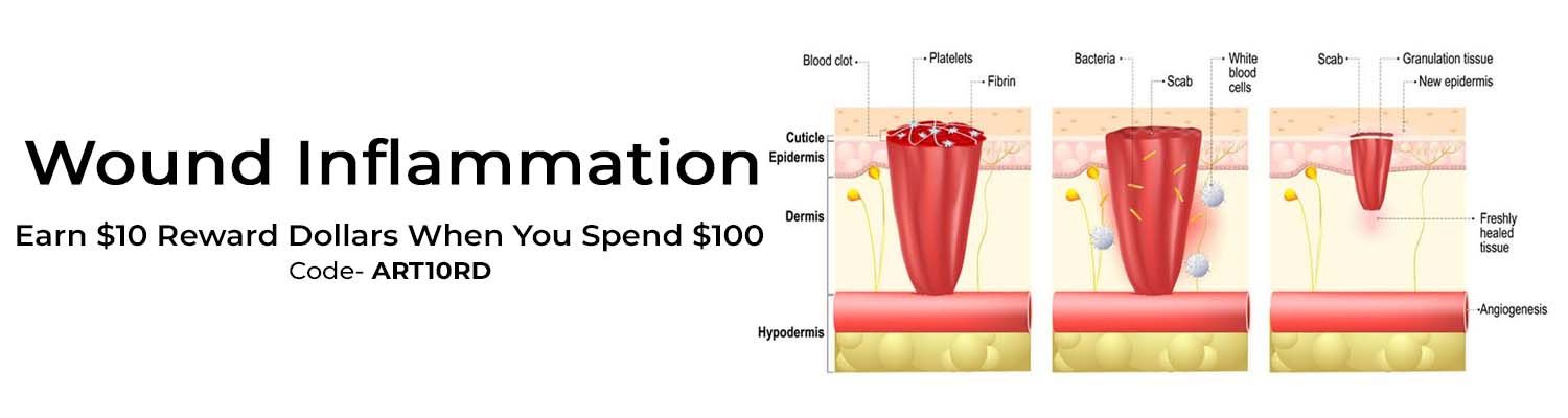 Understanding Wound Inflammation