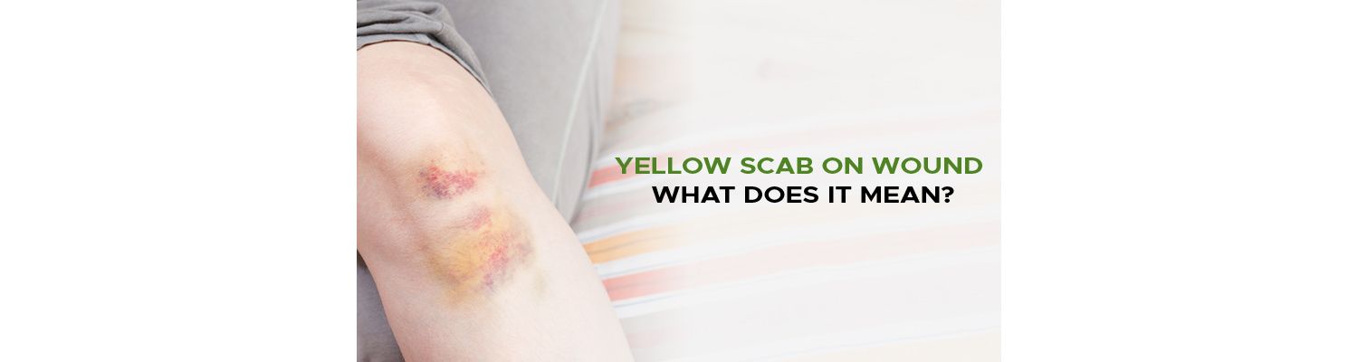 Yellow Scab on Wound - What Does It Mean?