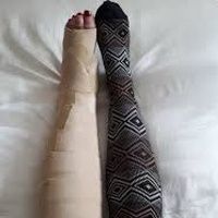 Buy Compression Bandage Retainers