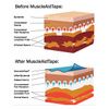 MuscleAidTape Elastic Kinesiology Tape