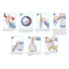 Lofric Hydro-Kit Intermittent Coude Catheter - Instructions