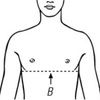 Bort Pediatric Back And Shoulder Posture Brace - Measurement Point