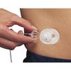Minimed Silhouette Infusion Set