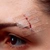 3M Steri-Strip Blend Tone Skin Closures