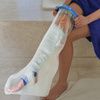Using Adult Leg Waterproof Cast ProtectorBJ110104