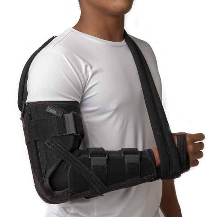 elbow fracture cast