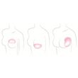 Trulife 823 ReCover Overlay Breast Form - Shape Diagram