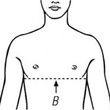 Bort Pediatric Back And Shoulder Posture Brace - Measurement Point
