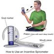 Carefusion Airlife Incentive Spirometer Usage