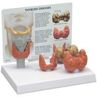 Buy Anatomical Thyroid Disease Model