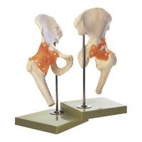 Buy Anatomical Functional Right Hip Joint Model
