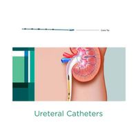 Buy Bard Polyurethane Ureteral Catheter