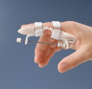 Rolyan Static Progressive Finger Extension Splint
