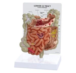 Anatomical Lower GI Tract Model