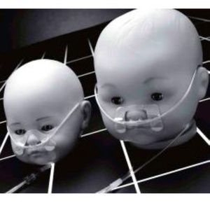 Tender Grip Skin Fixation System