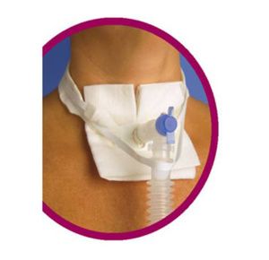 Pepper Medical Vent-Tie Ventilator Anti-disconnect Device