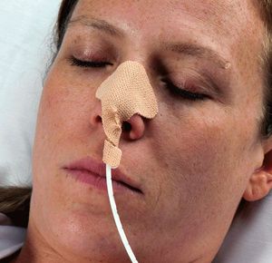 Dale NasoGastric Tube Holder