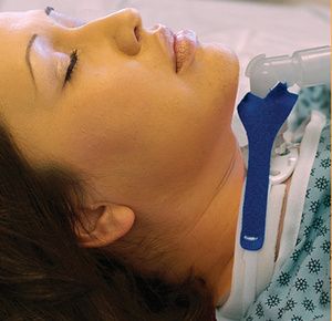 Marpac Pediatric Vent Circuit Anti-Disconnect Device