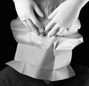 3M Steri-Drape Ophthalmic Surgical Refractive Drape