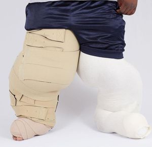 Medi USA CircAid Reduction Kit, Lobe