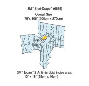 3M General Steri-Drape Abdominal Perineal with Incise Film