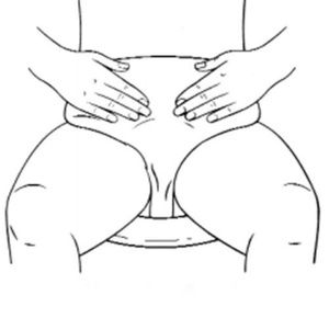 Nu-Hope Non-Adhesive Right Side Stoma Ileostomy Stater Set