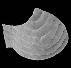 Wear Ease SP-09 Breast Swell Spot