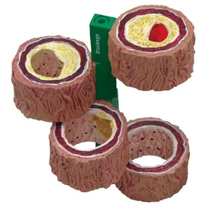 Buy Anatomical Four Piece Artery Model