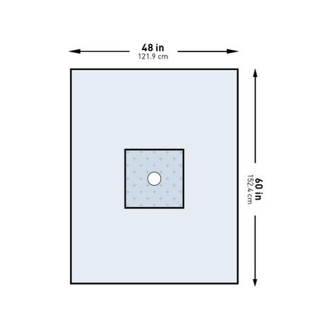 McKesson Minor Procedure Surgical Drape
