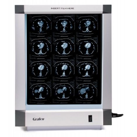 Graham Field X-Ray Illuminators