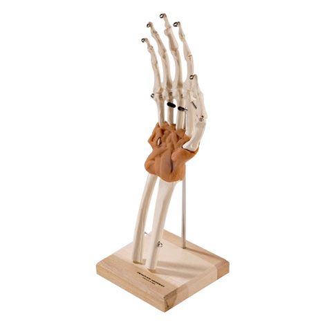 Ultra-Flex Ligamented Hand and Wrist