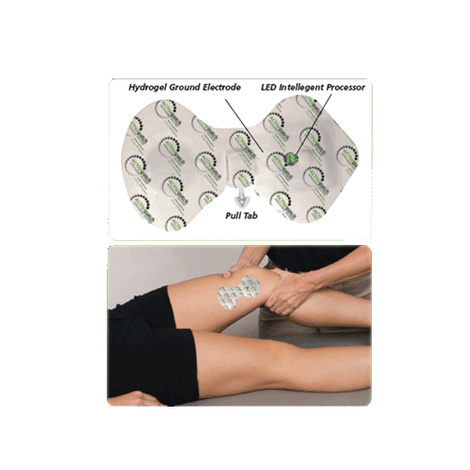 ActivaPatch Buffered Electronic Iontophoresis Drug Delivery System