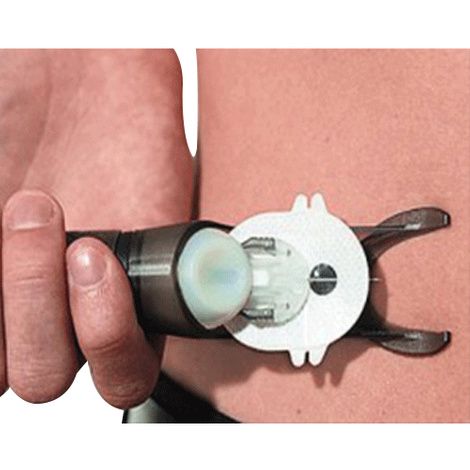 Minimed Sil-Serter Insertion Device For Silhouette Infusion Set
