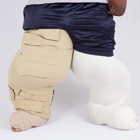 Medi USA CircAid Reduction Kit, Lobe