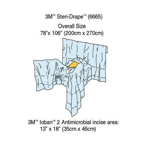 3M General Steri-Drape Abdominal Perineal with Incise Film
