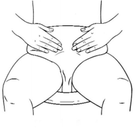 Hpfy StoresNu-Hope Non-Adhesive Left Side Stoma Ileostomy Starter Set