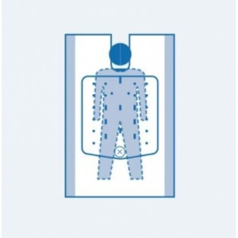 Mistral-Air Perioperative Warming Blanket