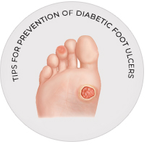 Tips For Prevention of Diabetic Foot Ulcers