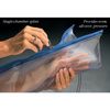 Urias Air Splint